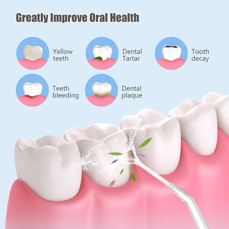 🦷 Draagbare Monddouche – Grondige reiniging en een perfecte glimlach