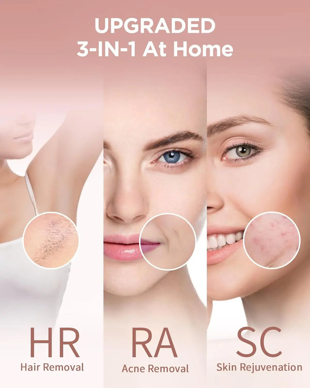 Professionele IPL-ontharing – Glade huid vanuit huis