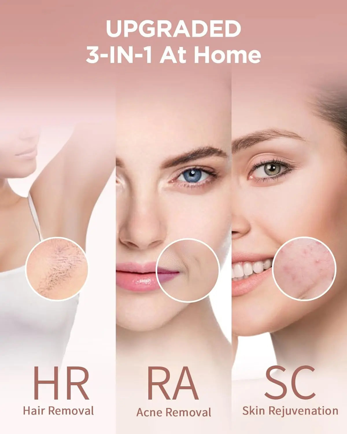 Professionele IPL-ontharing – Glade huid vanuit huis
