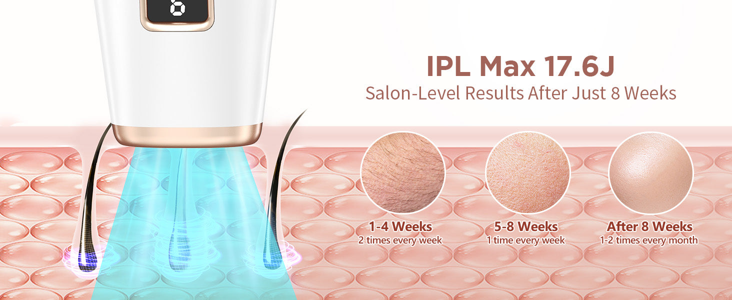 Professionele IPL-ontharing – Glade huid vanuit huis